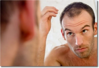 greffe cheveux